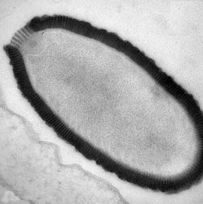 Un nouveau VIRUS GÉANT, vieux de 30.000 ans, réanimé et toujours infectieux – PNAS et CNRS