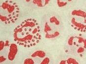 GONORRHÉE: Neisseria déplace colonise avec l'aide sperme mBio