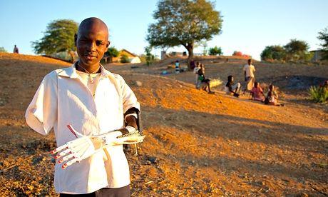 Daniel Omar avec sa nouvelle prothèse de bras, qui a été créé par une imprimante 3D à un coût