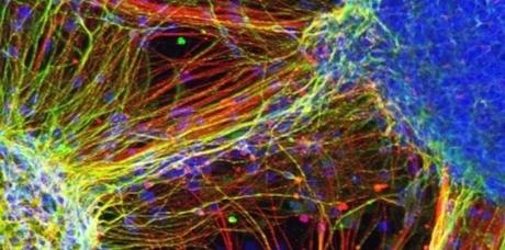 2731012-greffer-des-neurones-ca-marche-sur-des-souris