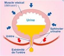 INCONTINENCE: Pourquoi quelques gouttes doivent inciter à consulter – L'incontinence, c'est quoi ?