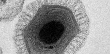 7031041-un-virus-geant-vieux-de-30-000-ans-decouvert-en-siberie