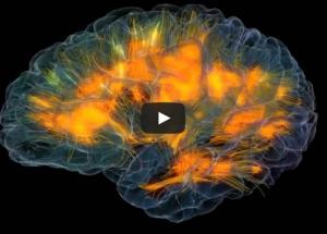 IMAGERIE: Le cerveau translucide dans tous ses états – UCSF