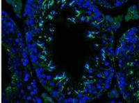INFERTILITÉ: Sans cette protéine, les spermatozoïdes perdent leurs moyens – The Journal of Cell Biology