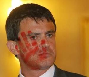 La santé n’a plus de prix valls la baffe