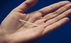 implant contraceptif
