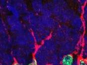 DÉPRESSION: Régénérer neurones, nouvelle piste thérapeutique Molecular Psychiatry