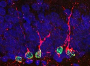 DÉPRESSION: Régénérer les neurones, la nouvelle piste thérapeutique – Molecular Psychiatry