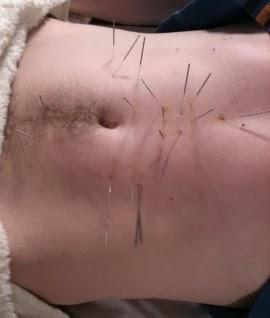 LES PARTIES ET L’ÉMERGENCE D’UN TOUT