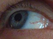 Love dans l’oeil cette femme