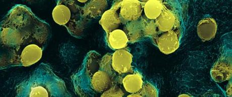 BACTERIE RESISTANCE ANTIBIOTIQUES