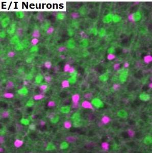 CERVEAU: Comment il garde l'équilibre entre excitation et inhibition – Nature