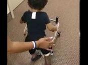 Amputé d’une jambe, enfant apprend marcher avec prothèse