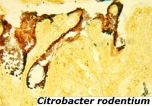 MICROBIOTE intestinal: Il révèle les signatures de maladies – PLoS ONE