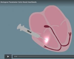 INSUFFISANCE CARDIAQUE: Vers un pacemaker biologique? – Science Translational Medicine
