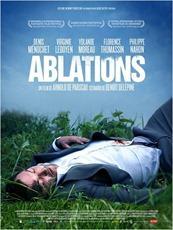 ablations