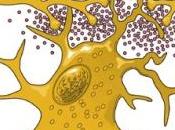PARKINSON: anti-inflammatoire secours neurones Journal Parkinson's Disease