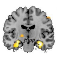 DÉVELOPPEMENT: L'apprentissage des maths mieux décrypté chez l'Enfant – Nature Neuroscience
