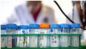 TABAGISME: Le gène qui augmente le risque de décès – International Journal of Epidemiology