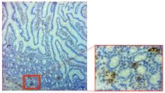 VIH: Ces cellules intestinales complices de l'infection – PLoS Pathogens