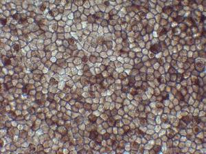 DMLA: Première greffe de cellules souches pour réparer la rétine  – Riken