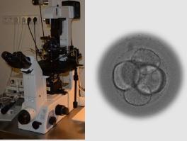 FIV: Pouvoir observer l'embryon en 3D avant l'implantation – CHRU de Montpellier