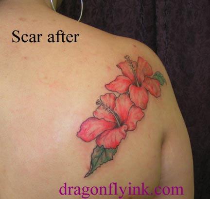 tattoo-camouflage-cicatrice-tatouage -scar-mogwaii (46)