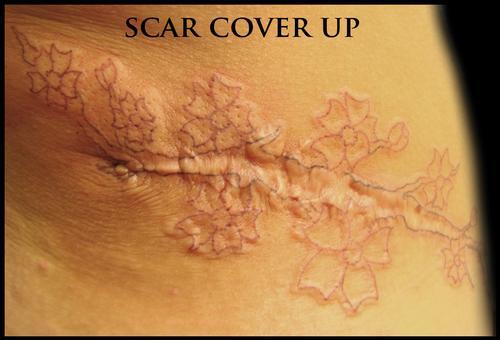 tattoo-camouflage-cicatrice-tatouage -scar-mogwaii (38)