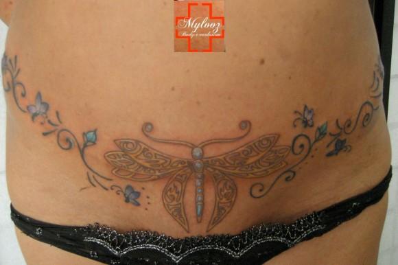 tattoo-camouflage-cicatrice-tatouage -scar-mogwaii (30)