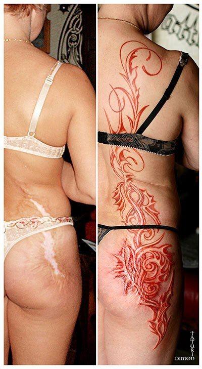 tattoo-camouflage-cicatrice-tatouage -scar-mogwaii (9)