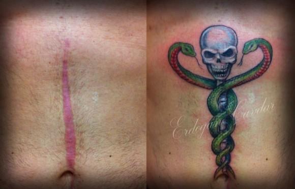 tattoo-camouflage-cicatrice-tatouage -scar-mogwaii (39)