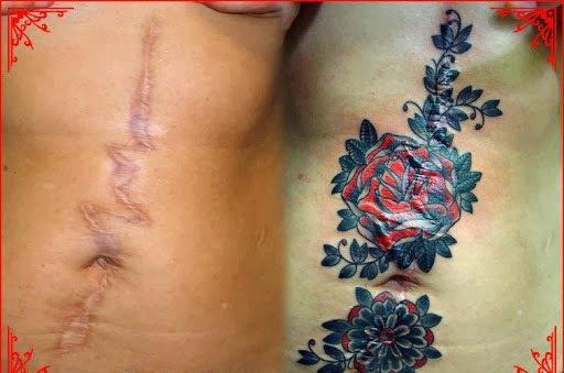 tattoo-camouflage-cicatrice-tatouage -scar-mogwaii (32)