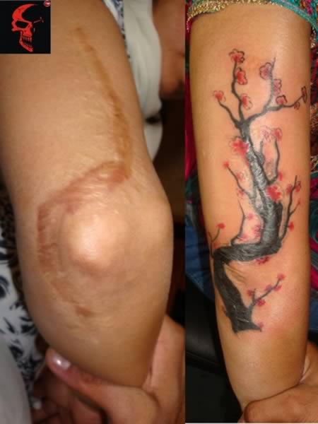 tattoo-camouflage-cicatrice-tatouage -scar-mogwaii (21)
