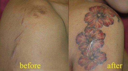 tattoo-camouflage-cicatrice-tatouage -scar-mogwaii (2)