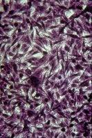 L’anonymat à pleine gorge… tranchée !