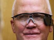 homme recouvre grâce bionique