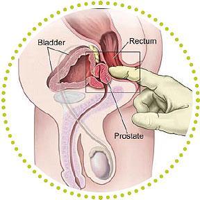 stimuler la prostate