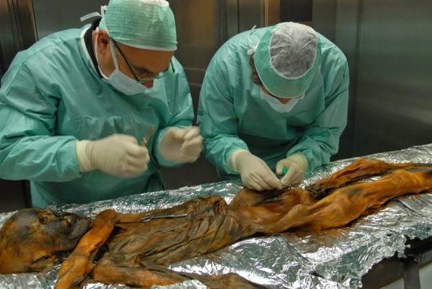 Ötzi: de l'ADN non humain dans l'échantillon d'un os
