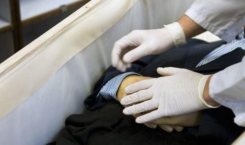 consevation du corps