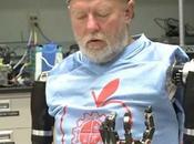 Leslie Baugh devient premier homme équipé deux bras bioniques