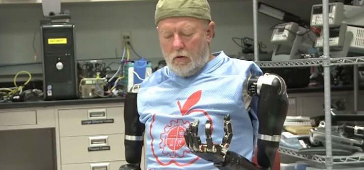 Leslie Baugh devient le premier homme équipé de deux bras bioniques