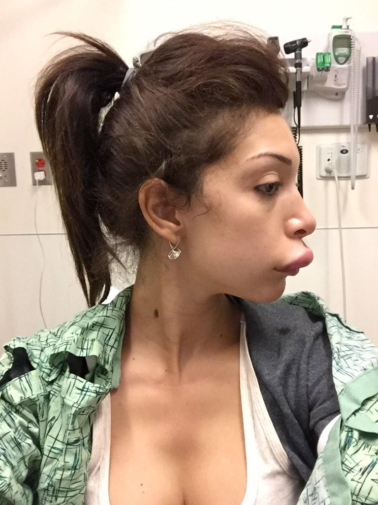 L'injection de botox qui tourne mal (Farrah Abraham)