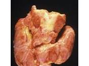 Est-ce qu’un problème glande thyroïde peut faire prendre poids