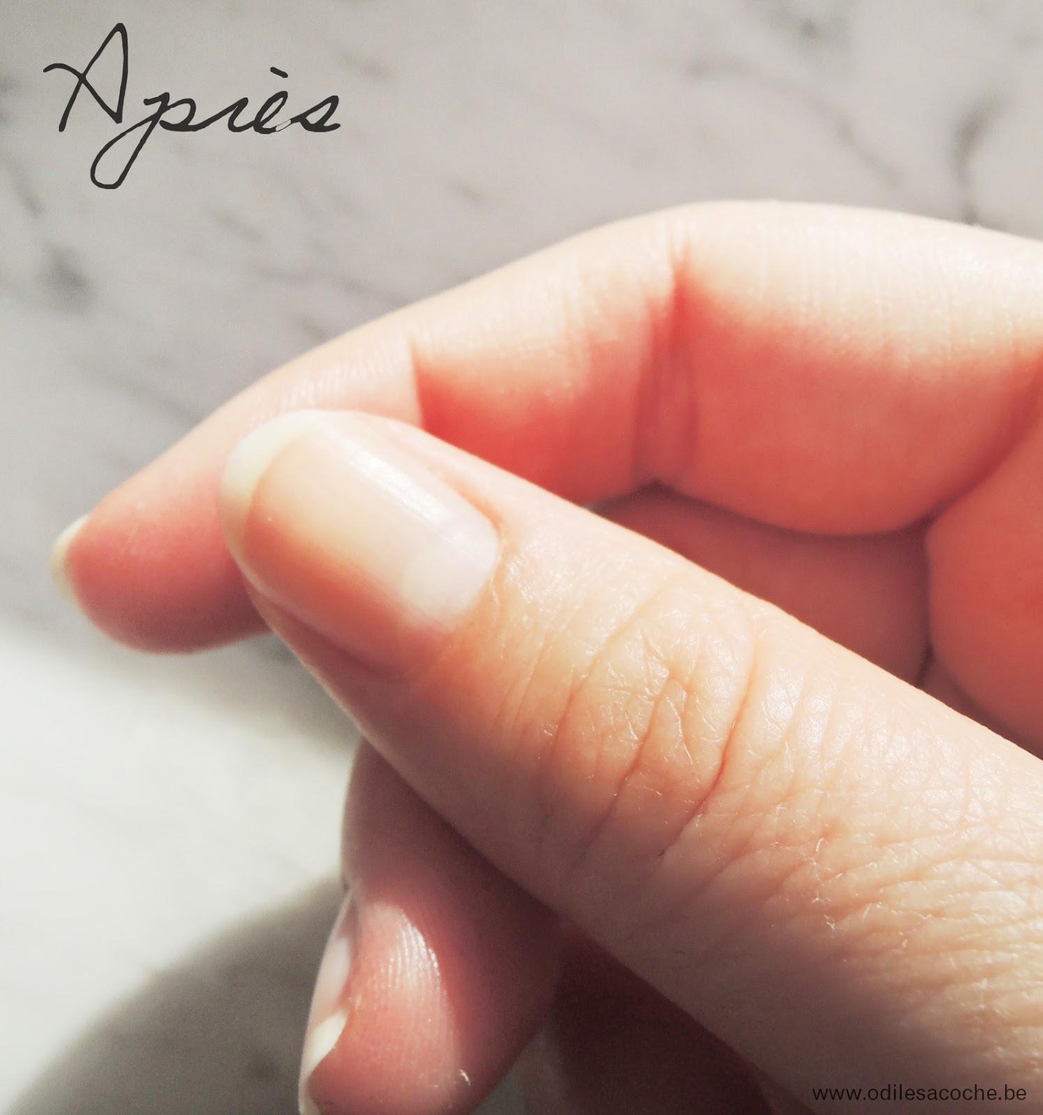 Retrouver de jolis ongles avec la cure Nailtiques
