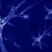 VIDEO. Que risque t-on à dormir trop peu ?