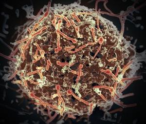 EBOLA: Le virus reste viable 7 jours post mortem  – Emerging Infectious Diseases