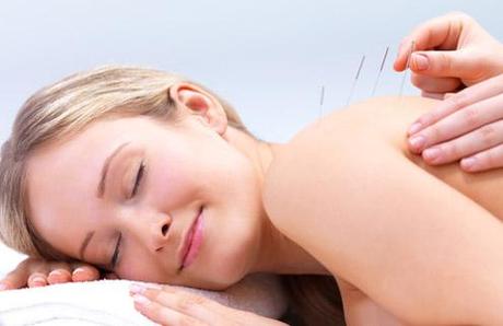 acupuncture femme enceinte