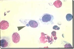 La chlamydiose féline ou chlamydophilose féline et l’intérêt de la vaccination .