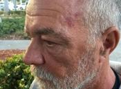 Violence excessive policier gifle (Etats-Unis)