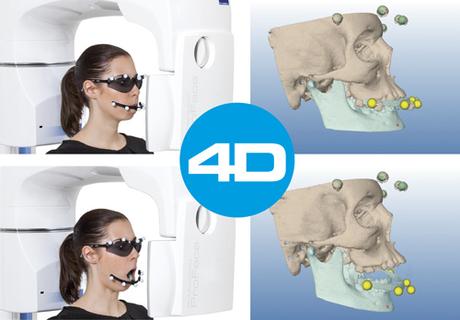 IDS 2015 : l'occlusion dynamique en image 3D